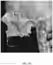 Fig. 14 - REDUCTION SPLINT FOR EDENTULOUS PATIENTS
