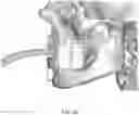 Fig. 31 - REDUCTION SPLINT FOR EDENTULOUS PATIENTS