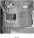 Fig. 36 - REDUCTION SPLINT FOR EDENTULOUS PATIENTS