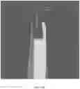 Fig. 40 - REDUCTION SPLINT FOR EDENTULOUS PATIENTS