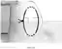 Fig. 41 - REDUCTION SPLINT FOR EDENTULOUS PATIENTS