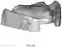 Fig. 45 - REDUCTION SPLINT FOR EDENTULOUS PATIENTS