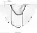 Fig. 46 - REDUCTION SPLINT FOR EDENTULOUS PATIENTS