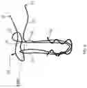 Fig. 09 - KNOTLESS INSTABILITY ANCHOR