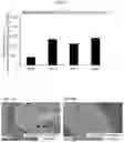 Fig. 09 - Therapy for polyglutamine (polyQ) diseases