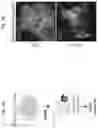 Fig. 02 - METHOD OF TREATING OR AMELIORATING CANCERS DRIVEN BY RECEPTOR TYROSINE KINASE FUSION ONCOGENES, AND COMPOSITIONS FOR THE SAME