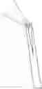 Fig. 01 - DEVICE FOR CONTINUOUS IRRIGATION WITH ACTIVATION IN ENDODONTICS APPLICATION