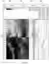 Fig. 03 - Gravity toolface for wellbores