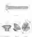 Fig. 02 - SCREW, SYSTEM COMPRISING A SCREW AND A PLATE, AND METHOD FOR PRODUCING A SCREW