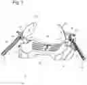 Fig. 02 - System, device and method for stable airway management