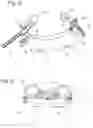 Fig. 03 - System, device and method for stable airway management
