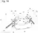 Fig. 09 - System, device and method for stable airway management