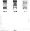 Fig. 02 - SYSTEMS AND PHARMACEUTICAL COMPOSITIONS FOR TREATMENT BY DIRECT INJECTION OF A TARGETED POPULATION OF CELLS