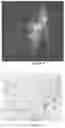 Fig. 07 - SYSTEMS AND PHARMACEUTICAL COMPOSITIONS FOR TREATMENT BY DIRECT INJECTION OF A TARGETED POPULATION OF CELLS