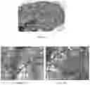 Fig. 08 - SYSTEMS AND PHARMACEUTICAL COMPOSITIONS FOR TREATMENT BY DIRECT INJECTION OF A TARGETED POPULATION OF CELLS