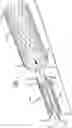 Fig. 02 - BRAIDED STENT WITH EXPANSION RING AND METHOD OF DELIVERY