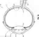 Fig. 02 - Enhancing optical detection of micro bubbles by laser pulse expansion