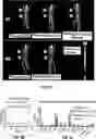 Fig. 07 - STRUCTURAL OPTIMIZATION METHOD TO IMPROVE THE THERANOSTIC PERFORMANCE OF PEPTIDE RECEPTOR-TARGETED RADIONUCLIDE THERAPY FOR CANCERS