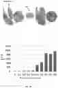 Fig. 06 - METHODS AND APPARATUS FOR OBTAINING FINE-GRAINED GLEASON GRADES AND PREDICTING CLINICAL OUTCOMES IN PROSTATE CANCER