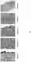 Fig. 07 - METHODS AND APPARATUS FOR OBTAINING FINE-GRAINED GLEASON GRADES AND PREDICTING CLINICAL OUTCOMES IN PROSTATE CANCER