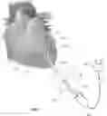 Fig. 02 - MEDIASTINUM ACCESS DEVICES AND METHODS