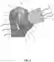 Fig. 02 - Tendon repair system