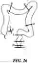 Fig. 20 - Surgical systems with port devices for instrument control