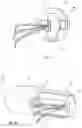 Fig. 06 - Annuloplasty device