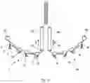 Fig. 10 - Annuloplasty device