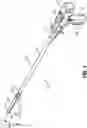 Fig. 02 - OVERLAPPING STAPLE PATTERN FOR SURGICAL STAPLER