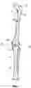 Fig. 02 - ARTHROPLASTY INSERT