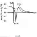 Fig. 07 - Brain Wave Analysis of Human Brain Cortical Function