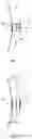 Fig. 04 - Noise reduction and identification device for acoustic protection headset