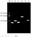 Fig. 02 - Genetically engineered strain with high yield of L-valine and method for producing L-valine by fermentation
