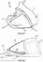 Fig. 37 - MULTI-COMPONENT GOLF CLUB HEAD