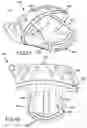 Fig. 43 - MULTI-COMPONENT GOLF CLUB HEAD