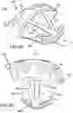 Fig. 44 - MULTI-COMPONENT GOLF CLUB HEAD