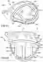 Fig. 46 - MULTI-COMPONENT GOLF CLUB HEAD