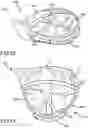 Fig. 47 - MULTI-COMPONENT GOLF CLUB HEAD