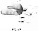 Fig. 02 - Technology adapted to facilitate user-specific calibration of instrumented mouthguard devices, including calibration methods for instrumented mouthguard devices