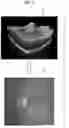 Fig. 06 - FUNDUS IMAGE PROCESSING APPARATUS AND NON-TRANSITORY COMPUTER-READABLE STORAGE MEDIUM