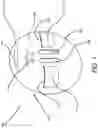 Fig. 02 - Tire Rim Shield