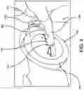Fig. 06 - Tire Rim Shield
