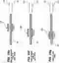 Fig. 27 - ACTIVE DRIVES FOR ROBOTIC CATHETER MANIPULATORS