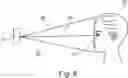 Fig. 09 - Hearing aid system integrable in an eyeglass frame