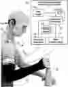 Fig. 01 - SYSTEMS AND METHODS FOR REDUCING SPASTICITY AFTER NEUROLOGICAL INJURY