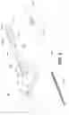 Fig. 05 - NEEDLE ASSEMBLY WITH EXTENDING SAFETY SHIELD