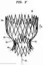 Fig. 03 - Collapsible and re-expandable prosthetic heart valve cuff designs and complementary technological applications