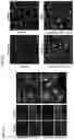 Fig. 07 - GENE THERAPY TREATMENT
