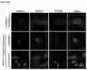 Fig. 09 - GENE THERAPY TREATMENT